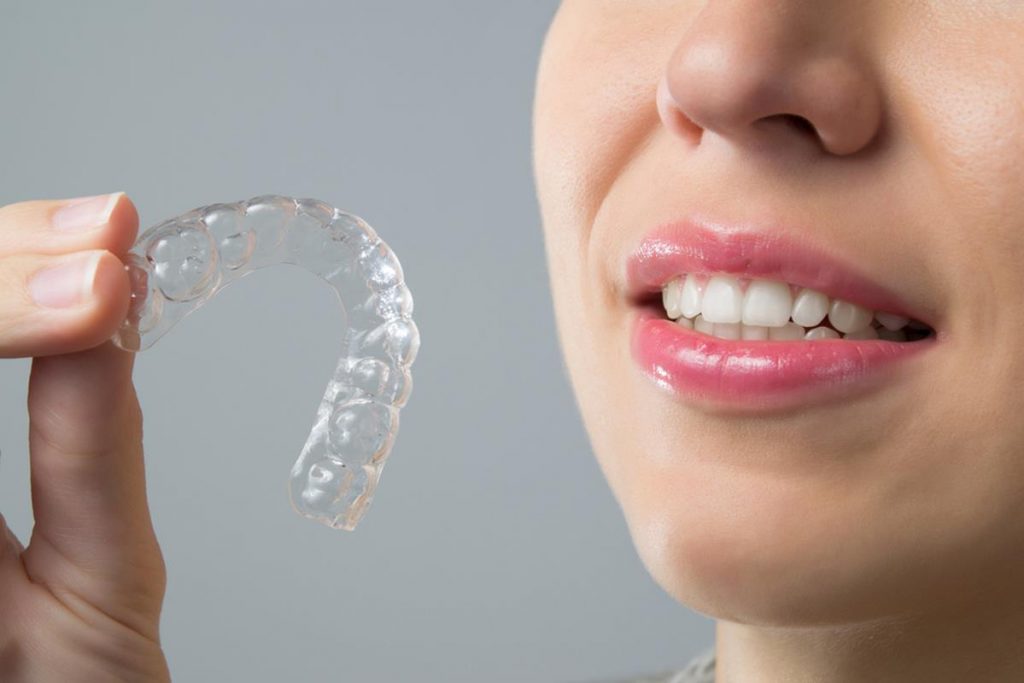 Invisalign® in San Antonio, TX Jennings and Ratliff Dental Invisalign® in San Antonio, TX Jennings and Ratliff Dental